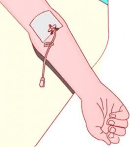 Химиотерапия