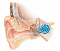 Слухопротезирование в Израиле