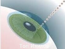 Микрохирургия глаза