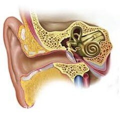 Мирингопластика