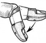 Палец-молоток