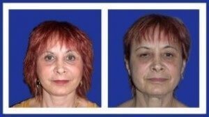 Пластическая хирургия в клинике Топ Ихилов