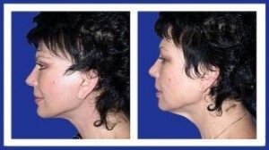 Пластические операции в клинике Топ Ихилов