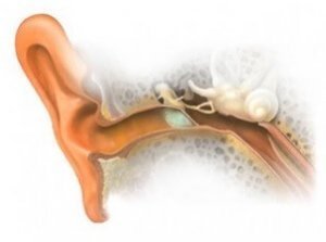 Стапедэктомия
