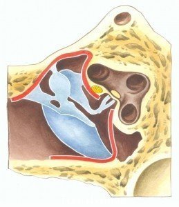 Тимпанопластика в Израиле