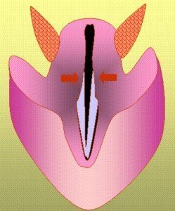 Лечение паралича голосовых связок в Израиле