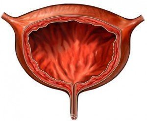Лечение заболеваний мочевого пузыря в Израиле