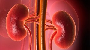 лечение рака почки в Израиле