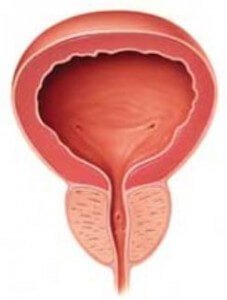 Заболевания предстательной железы