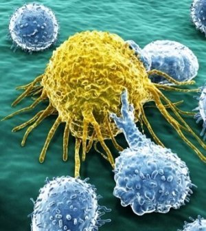 Лечение рака крови в Израиле