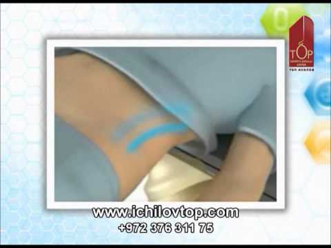 Мочекаменная болезнь